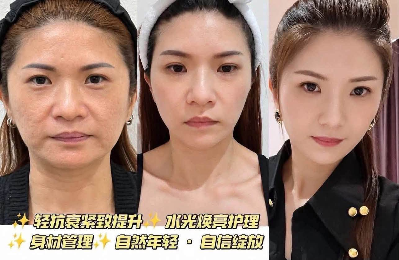 Three-stage TangMei facial rejuvenation journey