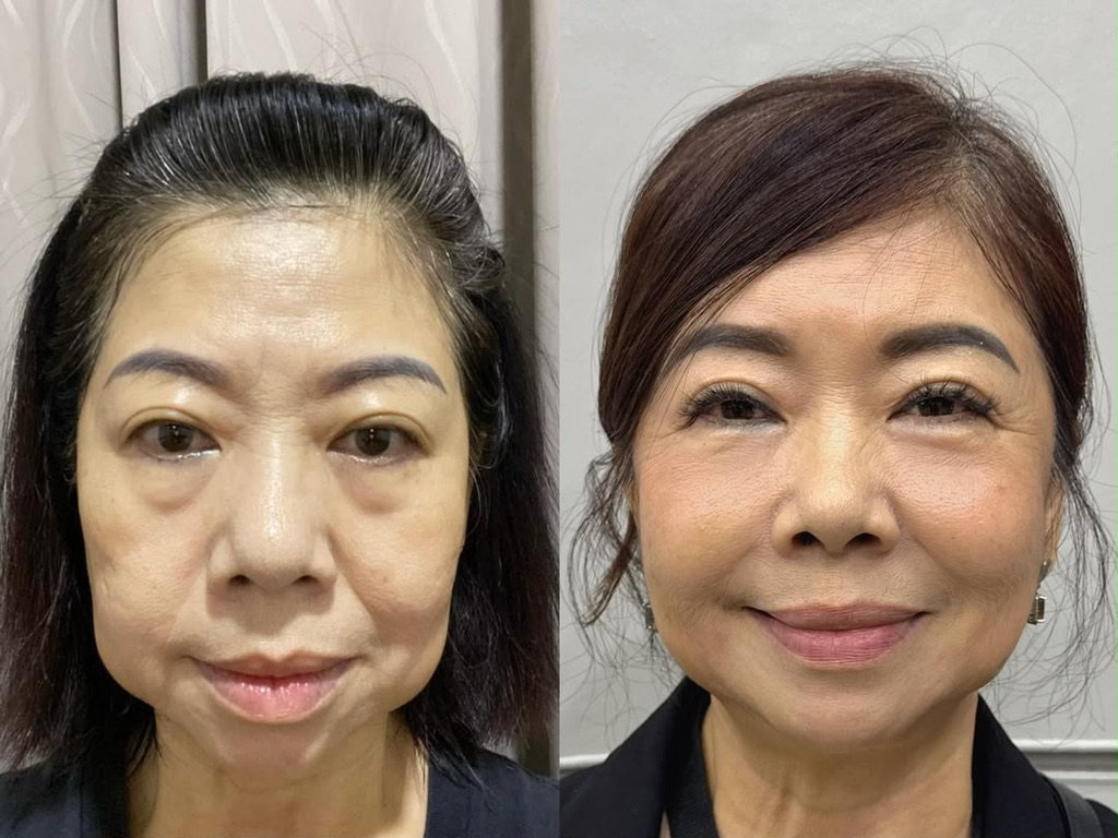 Female TM facial transformation, before on the left and after on the right